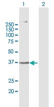 Anti-AGPAT5 Mouse Polyclonal Antibody