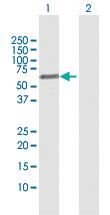 Anti-FSD1 Rabbit Polyclonal Antibody