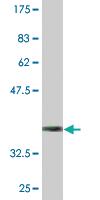 Anti-CTRB1 Mouse Monoclonal Antibody [clone: 3C8]