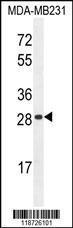 Anti-HPR Rabbit Polyclonal Antibody (APC (Allophycocyanin))