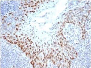 Immunohistochemical analysis of formalin-fixed, paraffin-embedded human tonsil using Anti-SOX2 Antibody [SOX2/4267R] at 2 µg/ml in PBS for 30 minutes at room temperature