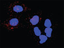 Anti-PLK1 + PKMYT1 Antibody Pair