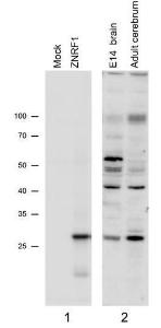 N2a expressing Mouse Znrf1 (mock transfection in first lane) and probed with Anti-ZNRF1 Antibody (A82537) (1 µg/ml), also staining of Mouse Brain lysates (Embryo E14 and adult cerebellum). Primary incubation was 1 hour. Detected by chemiluminescence