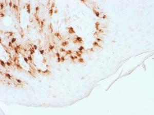 Immunohistochemical analysis of formalin-fixed, paraffin-embedded human skin using Anti-MelanA Antibody [MLANA/1761R]