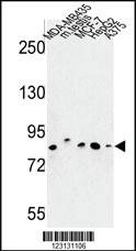 Anti-CHPF Rabbit Polyclonal Antibody