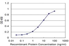 Anti-CAP1 Mouse Monoclonal Antibody [clone: 4A9]