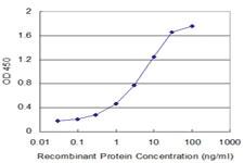 Anti-SLC1A2 Mouse Monoclonal Antibody [clone: 1D8]