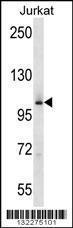 Anti-MAP4K2 Rabbit Polyclonal Antibody (Biotin)