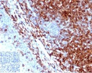 Anti-CD43 antibody