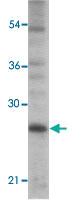 Anti-TICAM2 Rabbit Polyclonal Antibody