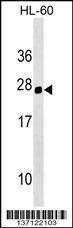 Anti-HOXC5 Rabbit Polyclonal Antibody (AP (Alkaline Phosphatase))