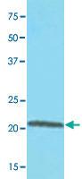 Anti-RBP4 Mouse Monoclonal Antibody [clone: AT2B4]