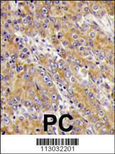 Anti-Myosin 1C Rabbit Polyclonal Antibody (HRP (Horseradish Peroxidase))