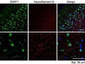 Anti-ZNRF1 Antibody (A82537) (10 µg/ml) staining of paraffin embedded Mouse Cerebral Cortex. Microwaved antigen retrieval with citrate buffer pH 6, streptavidine-Alexa 488-staining after biotinylated anti-goat secondary. The Neurofilament M was labeled by Millipore AB1987 (1:100)