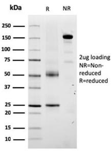 Anti-TRP1 Mouse Monoclonal Antibody [clone: TYRP1/3280]