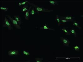 Anti-GAN Mouse Monoclonal Antibody [clone: 4G7]