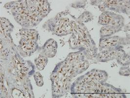 Anti-PAPSS2 Mouse Monoclonal Antibody [clone: 2A8]