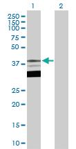 Anti-TFAP4 Rabbit Polyclonal Antibody