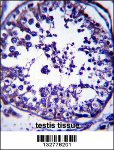 Anti-RAB5C Rabbit Polyclonal Antibody (FITC (Fluorescein Isothiocyanate))