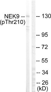 Western blot analysis of lysates from HepG2 cells using Anti-NEK9 (phospho Thr210) Antibody. The right hand lane represents a negative control, where the antibody is blocked by the immunising peptide.