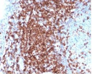 Anti-CD43 antibody