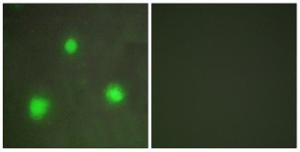 Immunofluorescence analysis of A549 cells using Anti-FOXH1 Antibody. The right hand panel represents a negative control, where the antibody was pre-incubated with the immunising peptide.