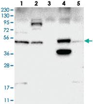 Anti-SNX30 Rabbit Polyclonal Antibody