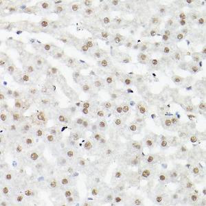 Immunohistochemistry analysis of paraffin-embedded mouse liver using Anti-LEO1 / RDL Antibody (A10520) at a dilution of 1:100 (40x lens). Perform high pressure antigen retrieval with 10 mM citrate buffer pH 6.0 before commencing with IHC staining protocol.