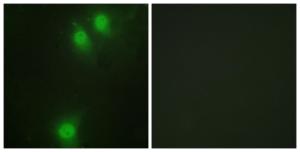 Immunofluorescence analysis of HeLa cells using Anti-NEK9 (phospho Thr210) Antibody. The right hand panel represents a negative control, where the antibody was pre-incubated with the immunising peptide.