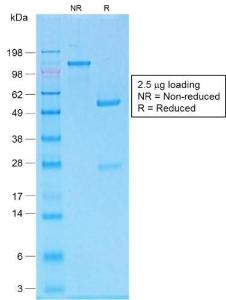 SDS-PAGE analysis of Anti-MelanA Antibody [MLANA/1761R] under non-reduced and reduced conditions; showing intact IgG and intact heavy and light chains, respectively. SDS-PAGE analysis confirms the integrity and purity of the antibody