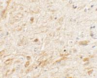 Anti-TMEM106A Rabbit Polyclonal Antibody