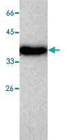 Anti-ADK Mouse Monoclonal Antibody [clone: 7]