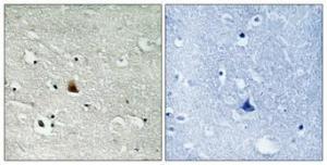 Immunohistochemical analysis of paraffin-embedded human brain using Anti-NEK9 (phospho Thr210) Antibody 1:100 (4°C overnight). The right hand panel represents a negative control, where the antibody was pre-incubated with the immunising peptide.