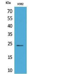 Western blot analysis of extracts from K562 cells using Anti-PPIB Antibody