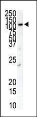 Anti-FLT3 Rabbit Polyclonal Antibody