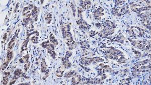 Anti-RBP4 Mouse Monoclonal Antibody [clone: AT2B4]