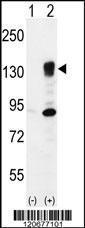 Anti-ITGA5 Rabbit Polyclonal Antibody (FITC (Fluorescein Isothiocyanate))