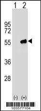 Anti-PACSIN3 Rabbit Polyclonal Antibody (Biotin)