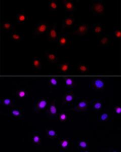 Immunofluorescence analysis of NIH/3T3 cells using Anti-LEO1 / RDL Antibody (A10520) at a dilution of 1:50 (40x lens). DAPI was used to stain the cell nuclei (blue).