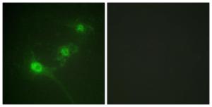 Immunofluorescence analysis of NIH/3T3 cells using Anti-LKB1 (phospho Ser428) Antibody. The right hand panel represents a negative control, where the Antibody was pre-incubated with the immunising peptide