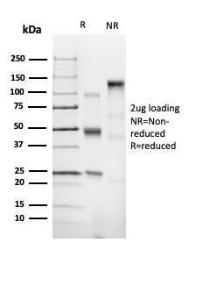 Anti-CD43 antibody