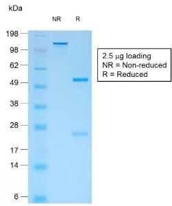 SDS-PAGE analysis of Anti-CD44v4 Antibody [rCD44v4/1219] under non-reduced and reduced conditions; showing intact IgG and intact heavy and light chains, respectively. SDS-PAGE analysis confirms the integrity and purity of the Antibody