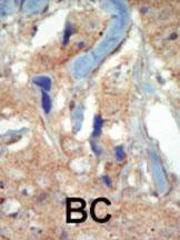 Anti-FLT3 Rabbit Polyclonal Antibody