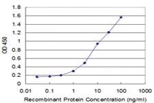 Anti-SLC2A4 Mouse Monoclonal Antibody [clone: 2A4]