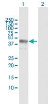 Anti-TARBP2 Rabbit Polyclonal Antibody