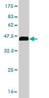 Anti-STXBP1 Mouse Monoclonal Antibody [clone: 6D1]