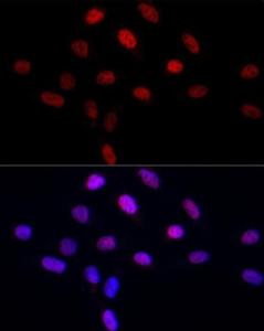 Immunofluorescence analysis of U2OS cells using Anti-LEO1 / RDL Antibody (A10520) at a dilution of 1:50 (40x lens). DAPI was used to stain the cell nuclei (blue).