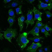 Hepa 1-6 cells, fixed with 4% PFA, stained with Anti-CD63 Antibody at a 1:50 dilution