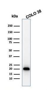 Western blot analysis of COLO-38 cell lysate using Anti-MelanA Antibody [MLANA/1761R]