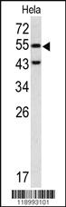 Anti-CASP8 Rabbit Polyclonal Antibody